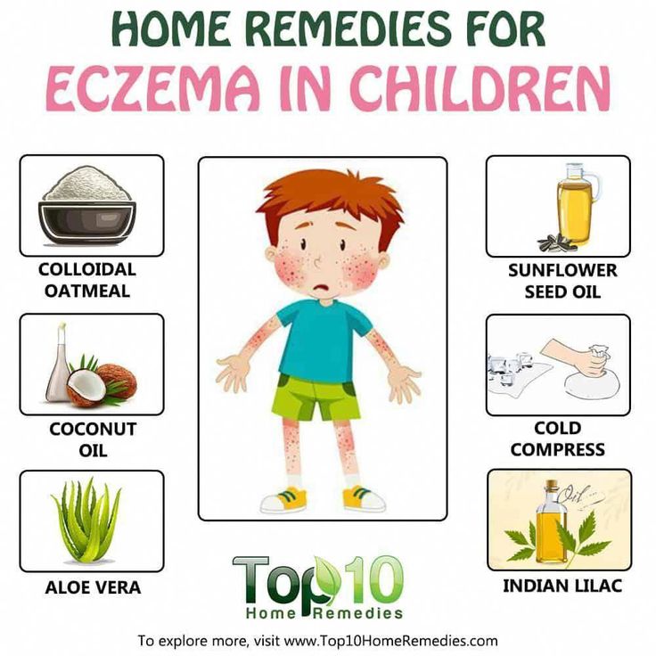 Foods that can cause eczema in babies