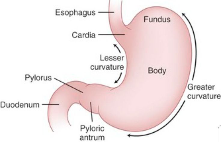 Do babies with pyloric stenosis vomit after every feeding