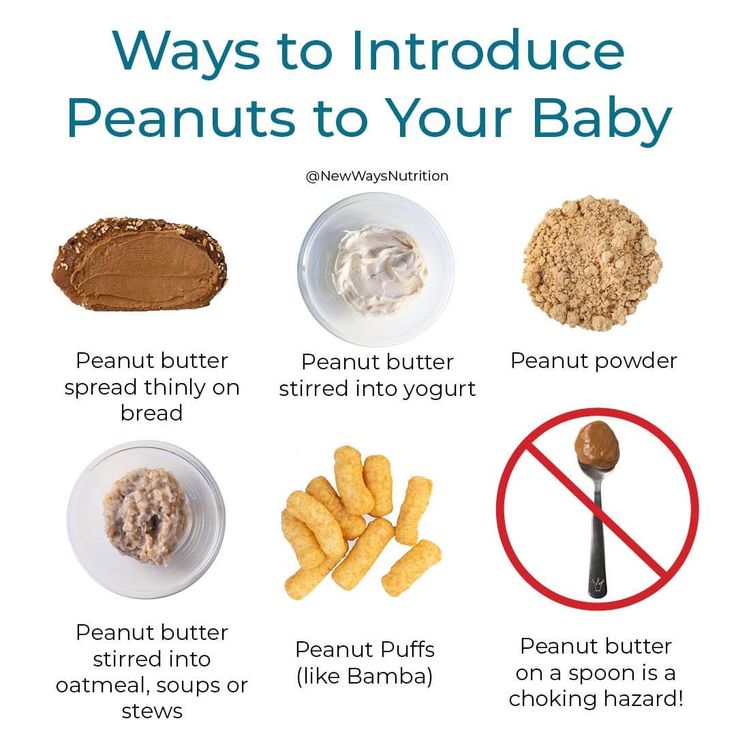 Cause of food allergies in babies