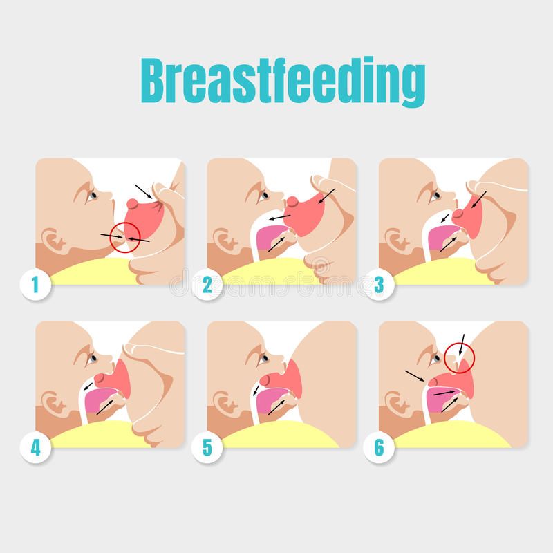 Triple feeding baby