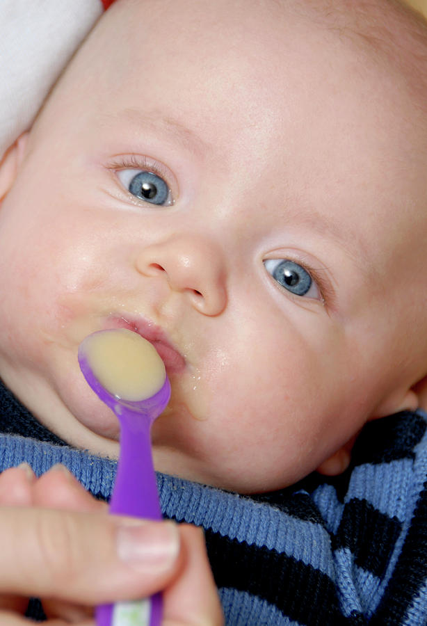 Feeding plates for cleft babies