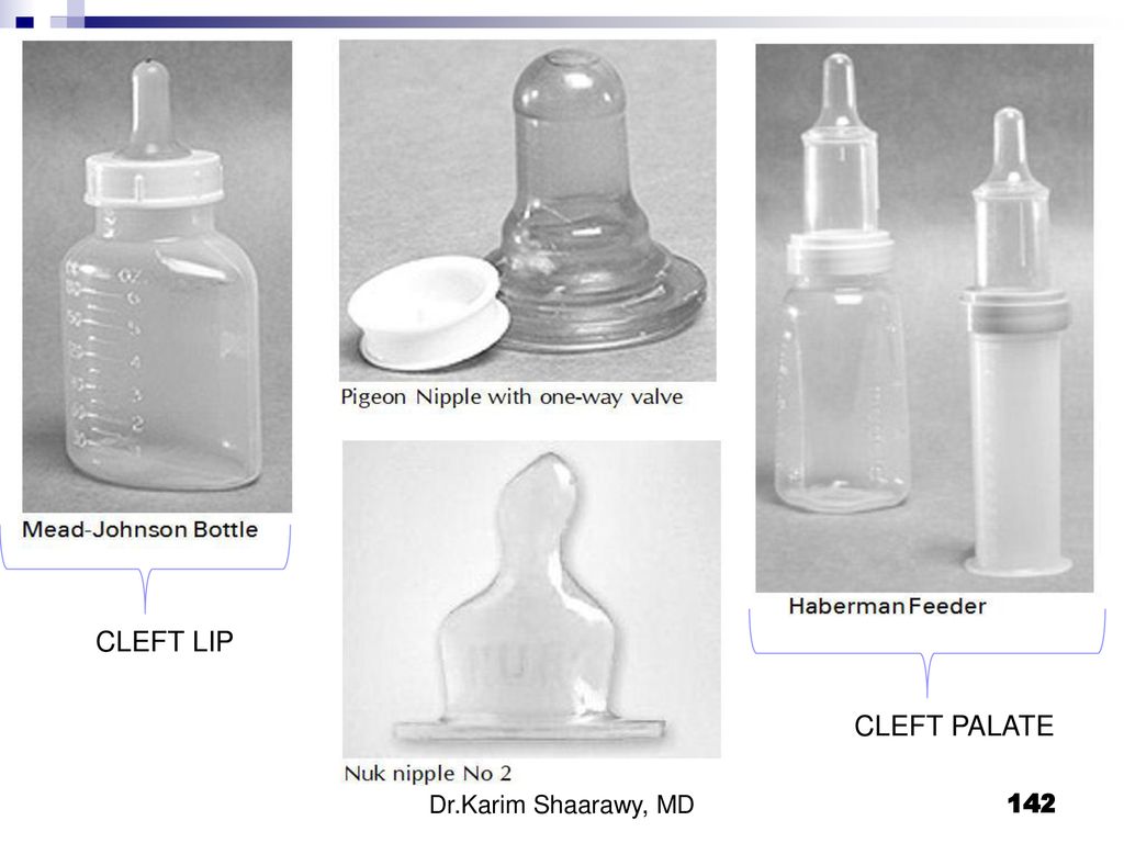 Bottle feeding positions for babies with reflux